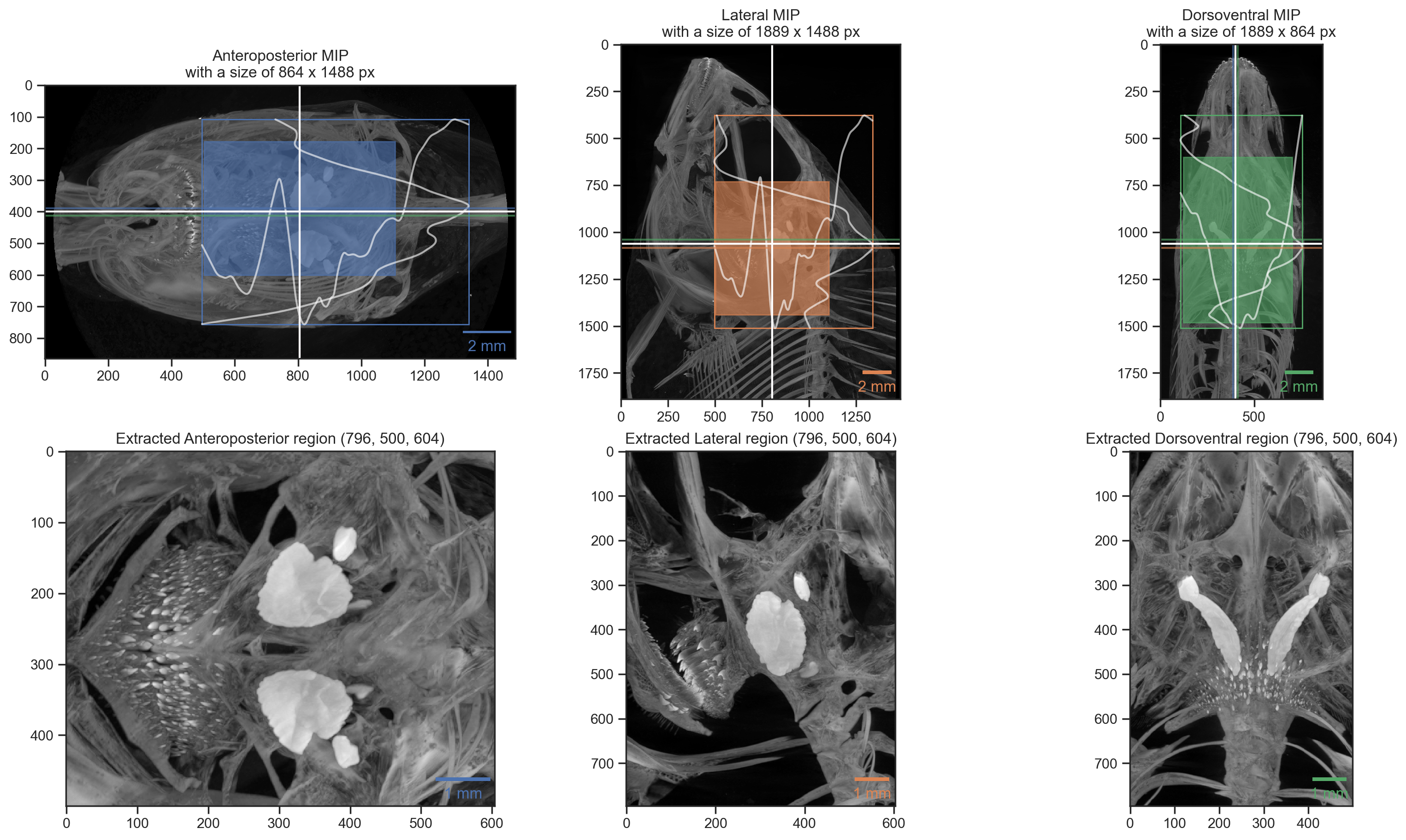 Figure 2: Visualization of automatic otolith extraction. The top row shows the found location of the otolith center in each of the three anatomical directions. The bottom row shows a maximum intensity projection of each of the three anatomical directions of the extracted otolith region.