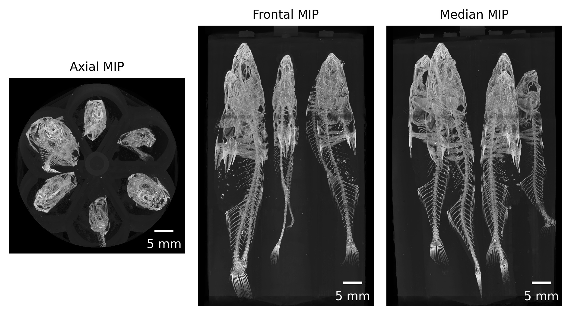 Figure 2: Maximum intensity projections of one acquired dataset along all three cardinal axes.